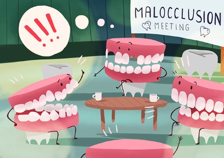 Malocclusion